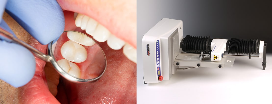 Horizontal Friction System on a Texture Analyser