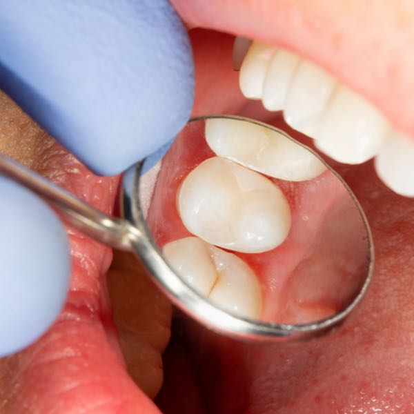 Pet chew configuration on a TA.HDplus texture analyser